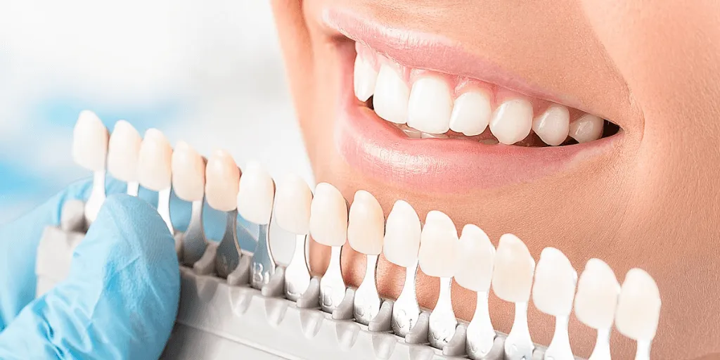 Dental Veneers Can Correct Countless Smile Flaws